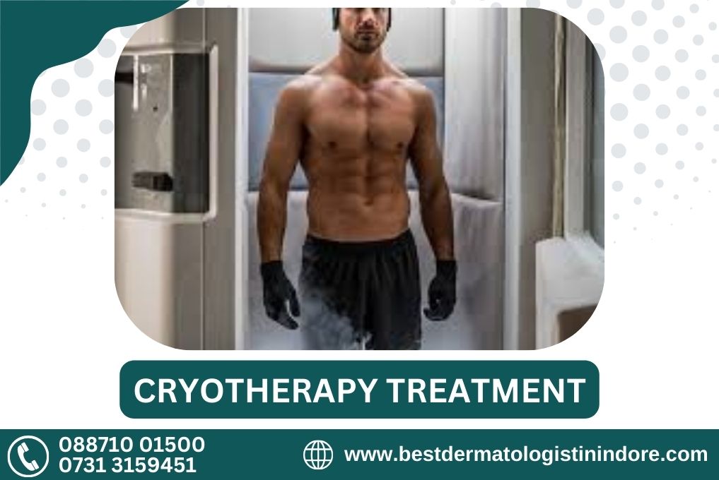 Best Cryothrerapy Treatment in Indore